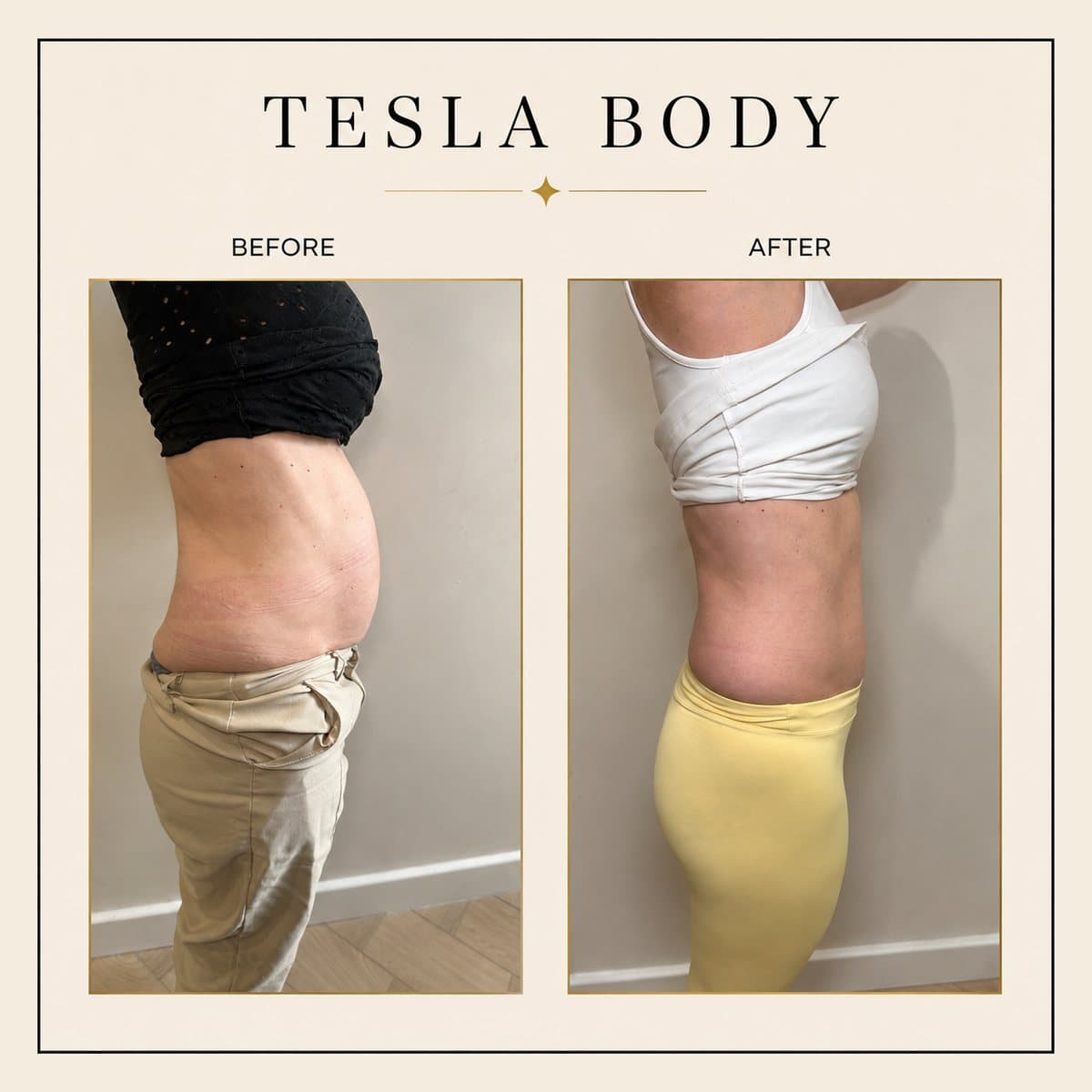 Ultra Tesla Body before and after at Totally Transformed Newcastle, core and abdomen