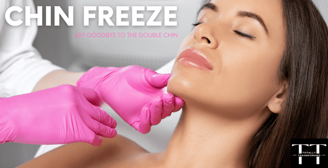 Chin Freeze: Say goodbye to the double chin