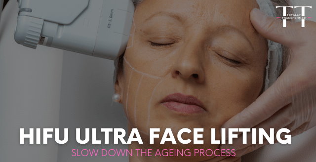 A woman undergoing the HIFU Ultra face lifting treatment