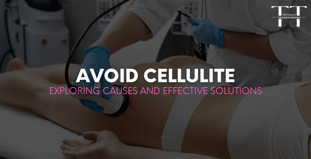 Avoid Cellulite: Exploring Causes and Effective Solutions Blog Banner
