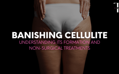 Banishing Cellulite: Understanding its Formation and Non-Surgical Treatments