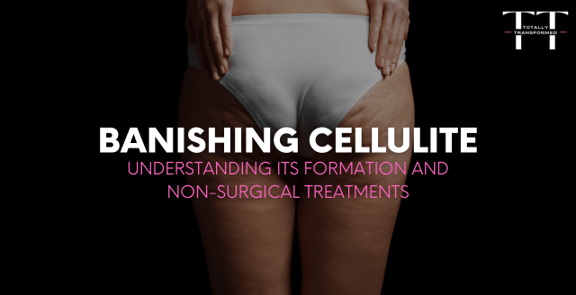cellulite and non surgical treatments