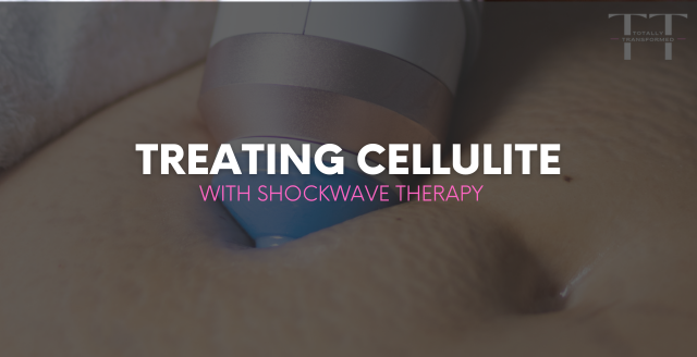 Treating Cellulite with Shockwave Therapy