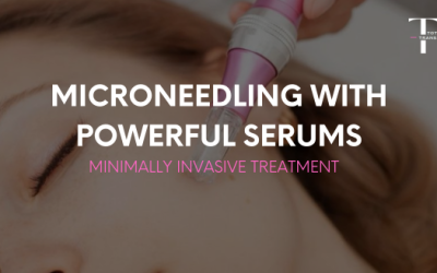 Microneedling with Powerful Serums