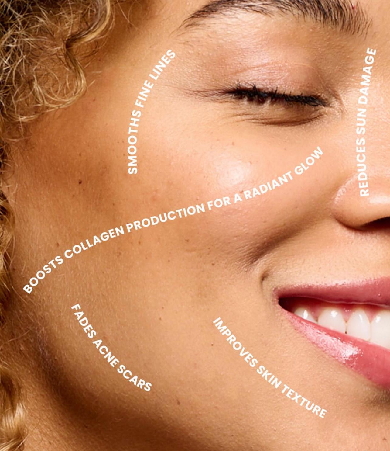 WhatsApp Image 2025-04-11 at 11.54.21_7c78834f microneeding. a number of different microneedling benefits overlaying an womans face
