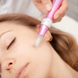microneedling. an image of a woman with a microneedling device resting on her face.