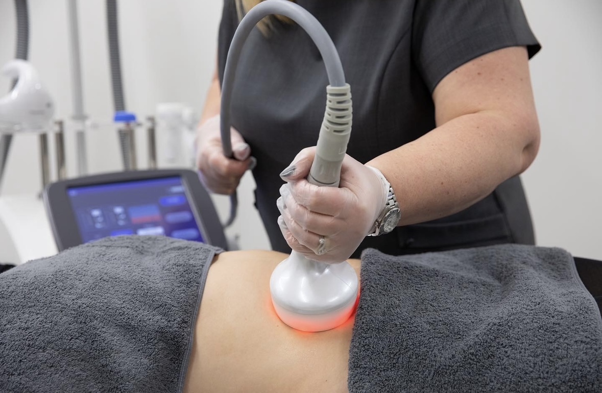 photo (4) Radio Frequency Skin Tightening